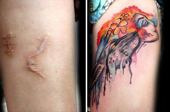 tatuaje sobre cicatrices 4
