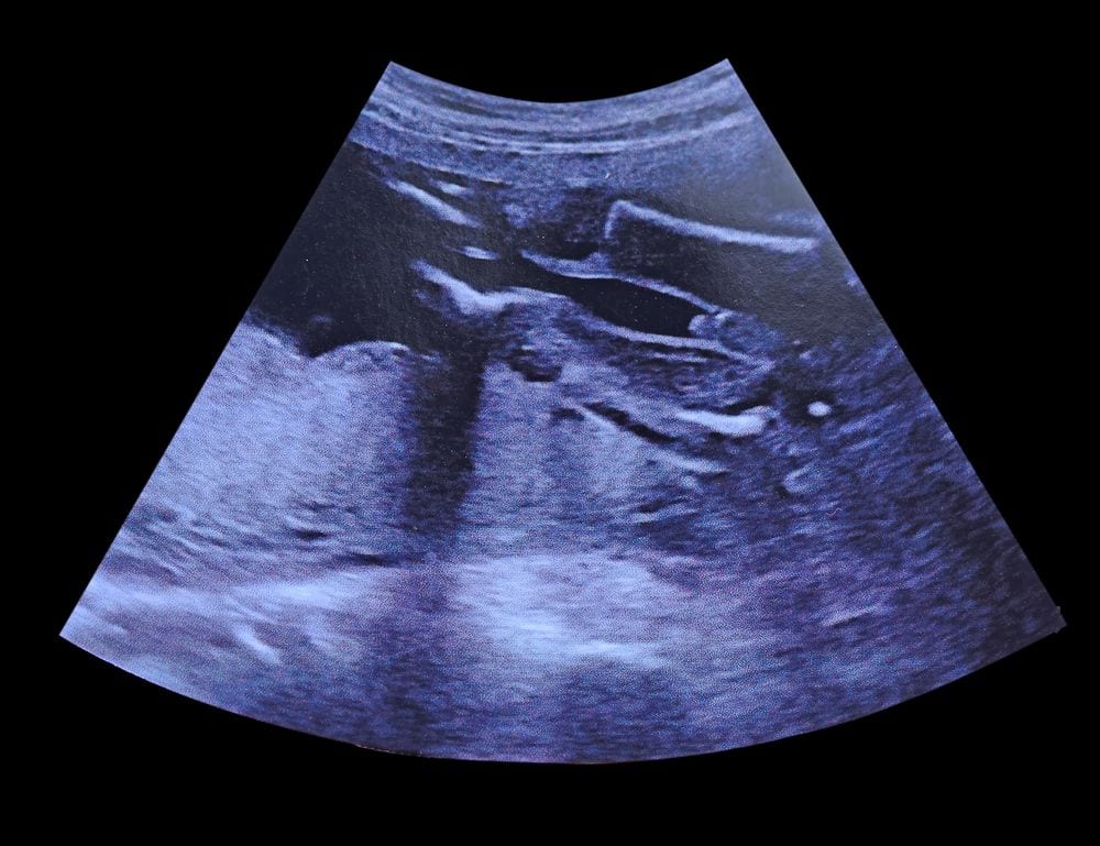embarazo-carta-aborto2